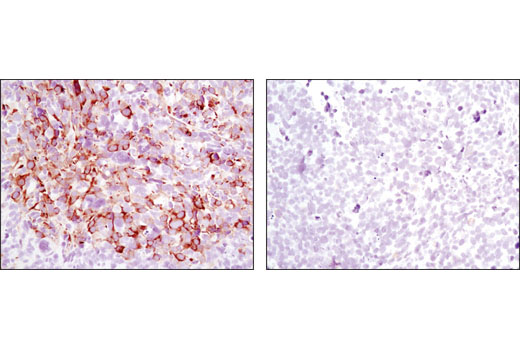 Immunohistochemistry Image 1: Phospho-S6 Ribosomal Protein (Ser240/244) (D68F8) XP® Rabbit mAb (BSA and Azide Free)