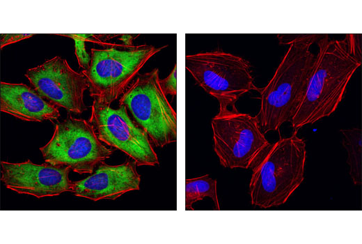 Immunofluorescence Image 1: Phospho-S6 Ribosomal Protein (Ser240/244) (D68F8) XP® Rabbit mAb