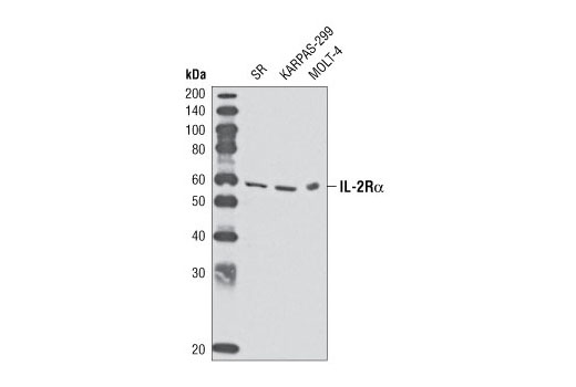 Western Blotting Image 1: IL-2Rα Antibody