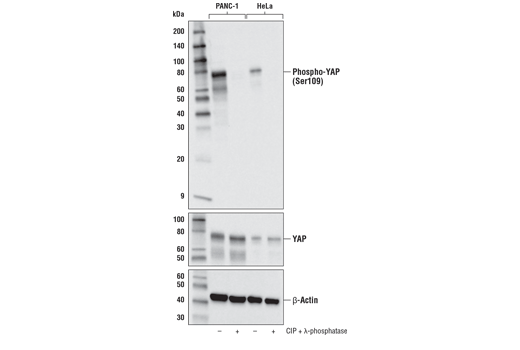  Image 9: PhosphoPlus® YAP (Ser109) Antibody Duet