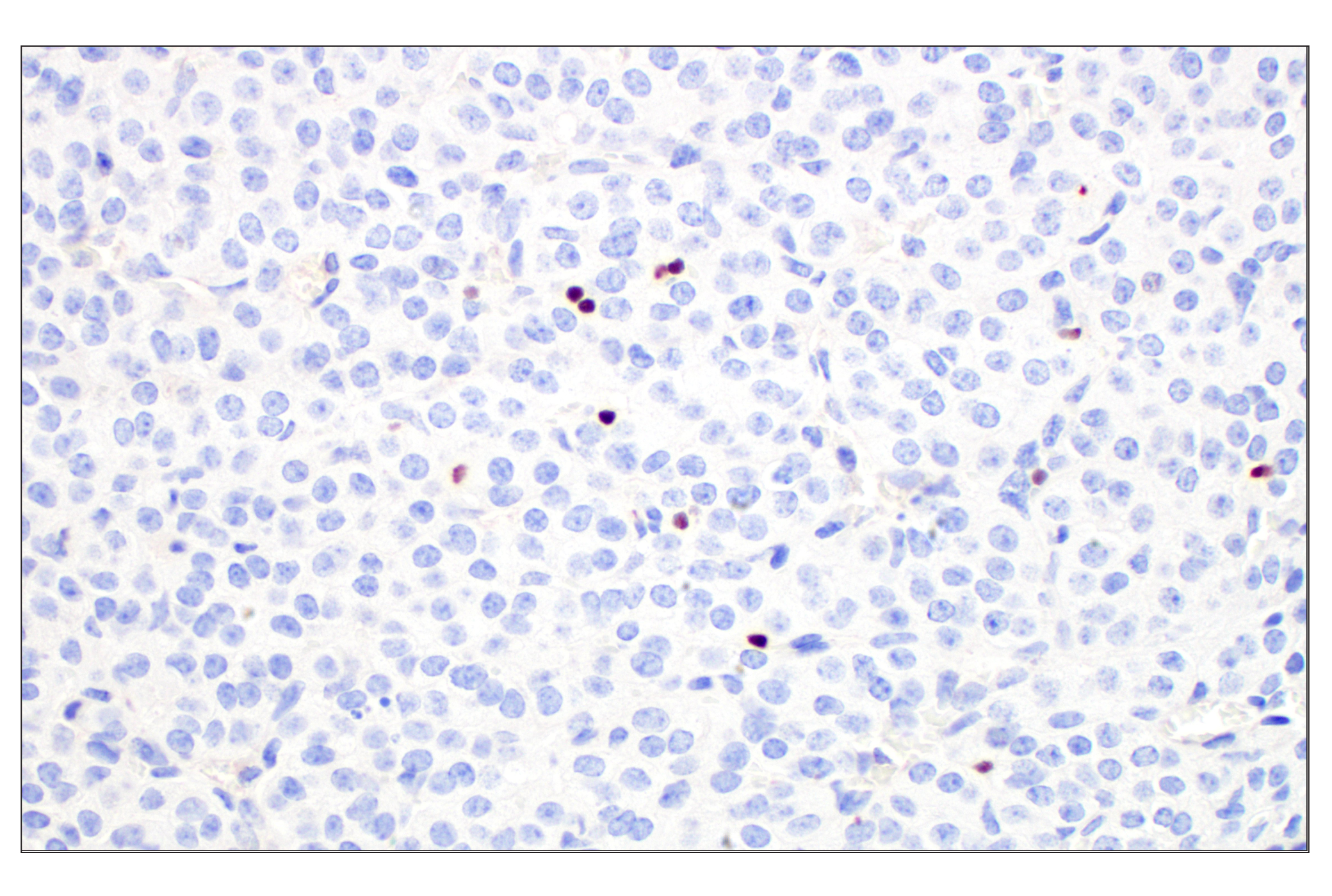 Immunohistochemistry Image 8: T-bet/TBX21 (E4I2K) Rabbit mAb (BSA and Azide Free)