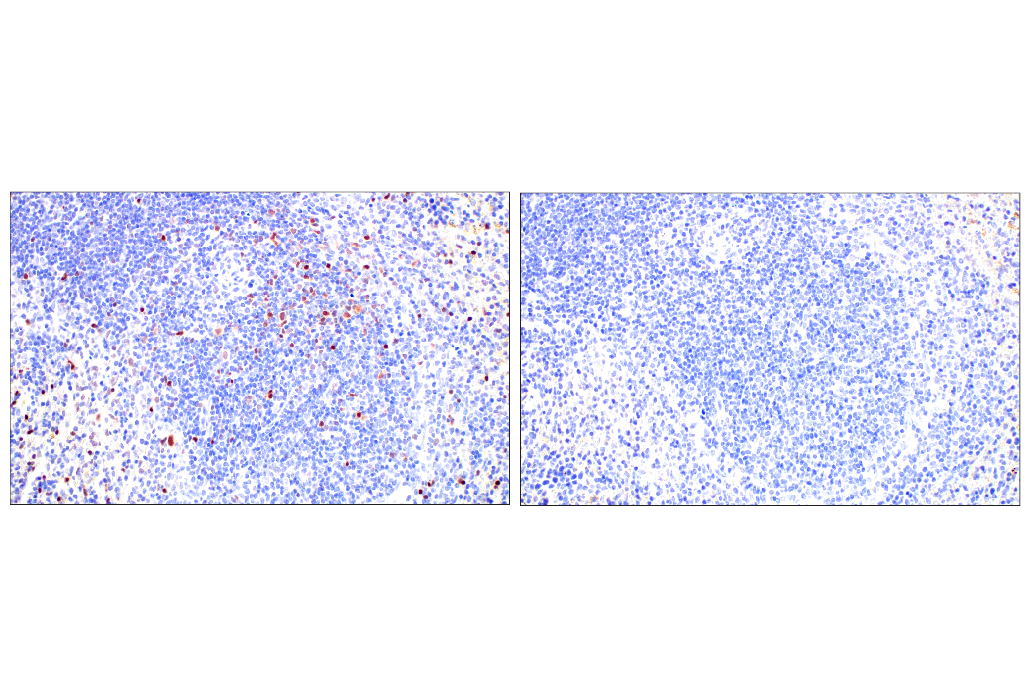 Immunohistochemistry Image 13: T-bet/TBX21 (E4I2K) Rabbit mAb (BSA and Azide Free)
