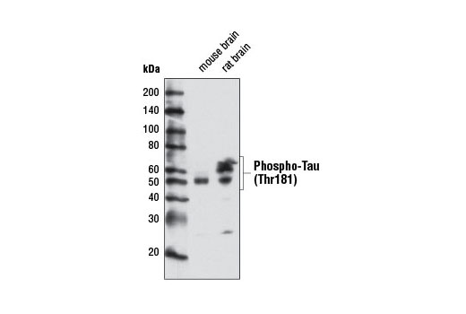 Western Blotting Image 2: Phospho-Tau (Thr181) Antibody