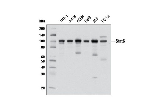  Image 12: Stat Antibody Sampler Kit II