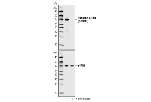 Western Blotting Image 1: Phospho-eIF4B (Ser406) Antibody
