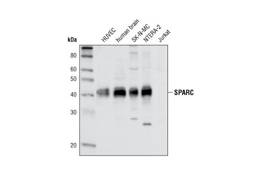 Western Blotting Image 1: SPARC Antibody