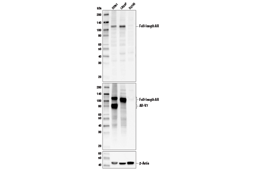 Western Blotting Image 1: Androgen Receptor Antibody (Carboxy-terminal Antigen)