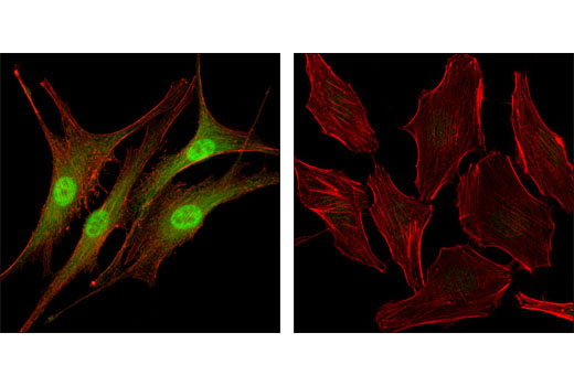 Immunofluorescence Image 1: Livin (D61D1) XP® Rabbit mAb