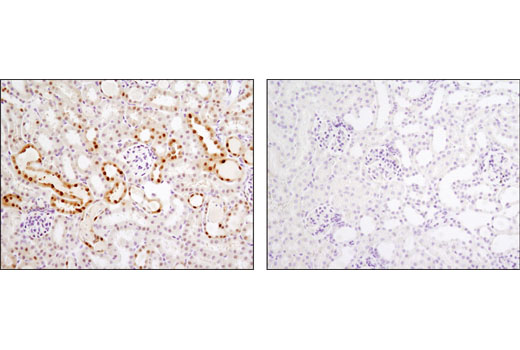 Immunohistochemistry Image 3: Vitamin D3 Receptor (D2K6W) Rabbit mAb (BSA and Azide Free)