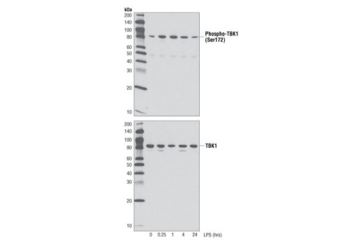  Image 2: PhosphoPlus® TBK1/NAK (Ser172) Antibody Duet