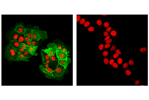 Immunofluorescence Image 1: Tissue Factor/CD142 (E2Y6L) Rabbit mAb