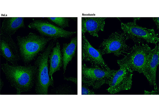 Immunofluorescence Image 1: JIP4/SPAG9 (D72F4) XP® Rabbit mAb