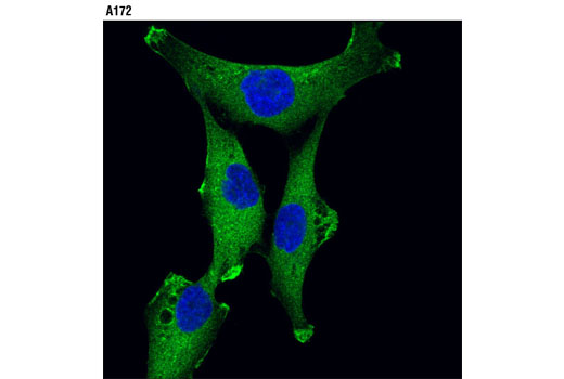 Immunofluorescence Image 2: JIP4/SPAG9 (D72F4) XP® Rabbit mAb