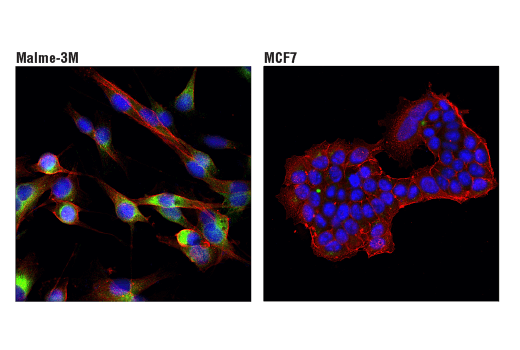 Immunofluorescence Image 1: Cathepsin B (D1C7Y) XP® Rabbit mAb (Alexa Fluor® 488 Conjugate)