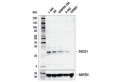  Image 6: Jak/Stat Pathway Inhibitors Antibody Sampler Kit