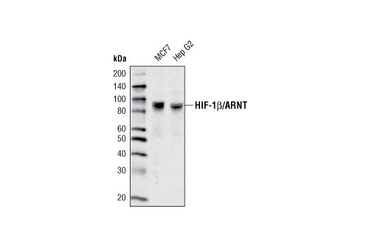  Image 11: Hypoxia Activation IHC Antibody Sampler Kit