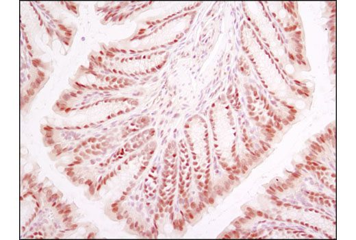  Image 21: Hypoxia Pathway Antibody Sampler Kit