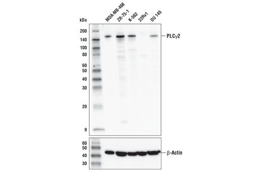  Image 9: PLCγ Antibody Sampler Kit