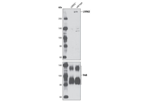Western Blotting Image 1: LRRK2 Antibody