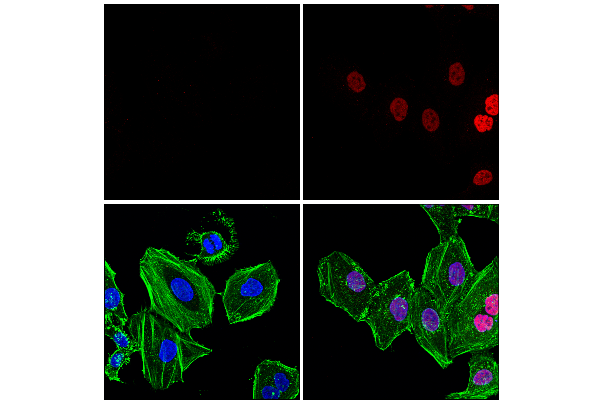Immunofluorescence Image 1: Phospho-Stat1 (Tyr701) (58D6) Rabbit mAb (Alexa Fluor® 594 Conjugate)