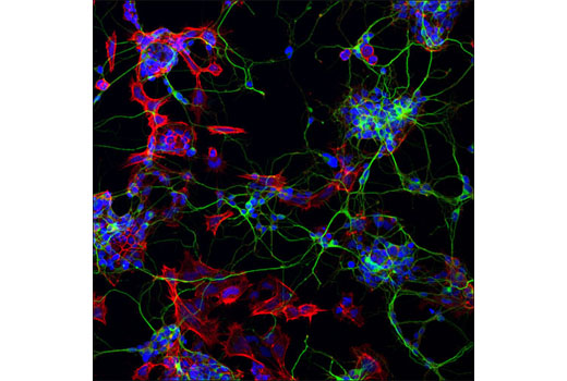 Immunofluorescence Image 2: β3-Tubulin (D71G9) XP® Rabbit mAb