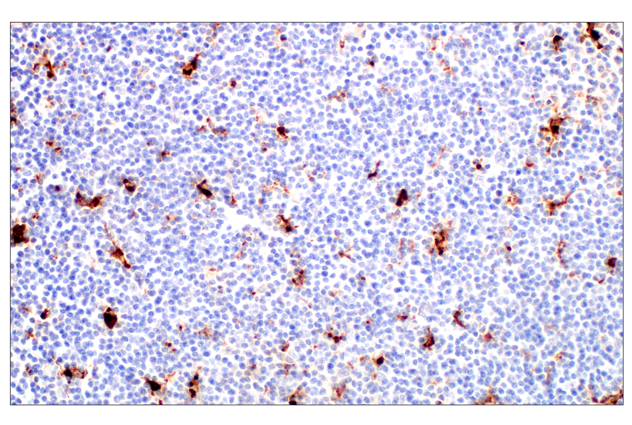 Immunohistochemistry Image 7: Cathepsin L (E3R3P) Rabbit mAb