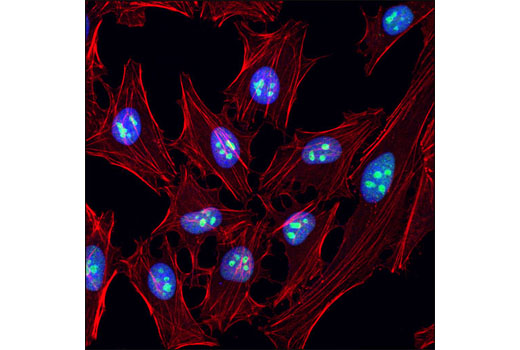 Immunofluorescence Image 1: SENP3 (D20A10) XP® Rabbit mAb
