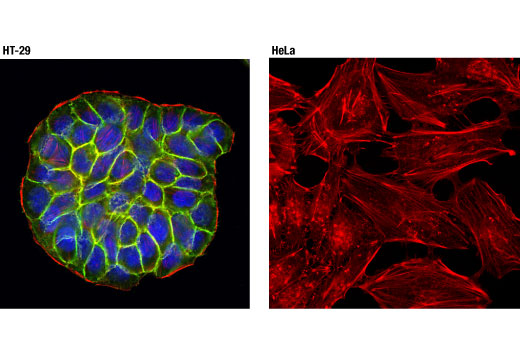 Immunofluorescence Image 1: EpCAM (D4K8R) XP® Rabbit mAb (BSA and Azide Free)