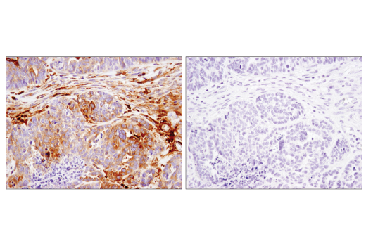 Immunohistochemistry Image 5: IFIT1 (D2X9Z) Rabbit mAb (BSA and Azide Free)