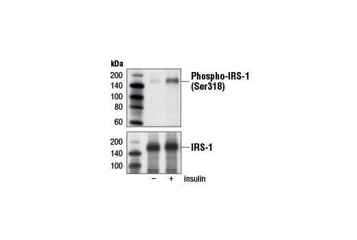  Image 5: Insulin Receptor Substrate Antibody Sampler Kit
