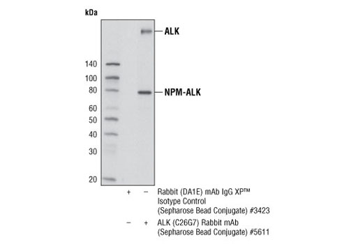 Immunoprecipitation Image 1: ALK (C26G7) Rabbit mAb (Sepharose® Bead Conjugate)