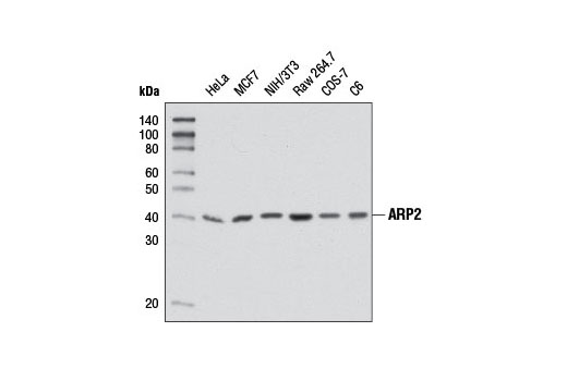  Image 5: Actin Nucleation Antibody Sampler Kit
