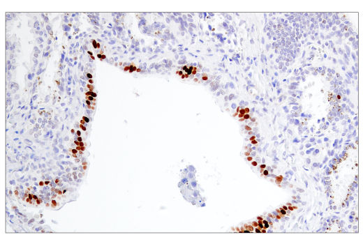 Immunohistochemistry Image 7: BCL6 (E5I8I) Rabbit mAb (BSA and Azide Free)