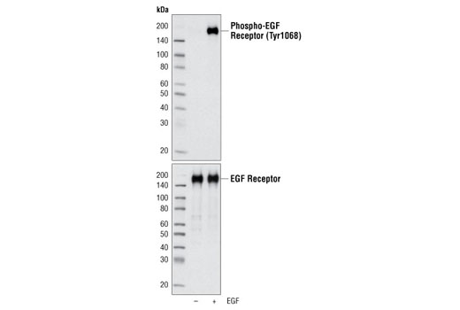 Western Blotting Image 1: EGF Receptor Control Cell Extracts