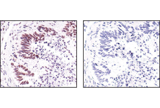 Immunohistochemistry Image 3: Survivin (71G4B7) Rabbit mAb (BSA and Azide Free)