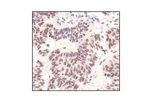 Immunohistochemistry Image 4: Survivin (71G4B7) Rabbit mAb (BSA and Azide Free)
