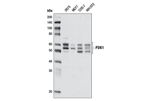  Image 3: PTEN and PDK1 Antibody Sampler Kit II