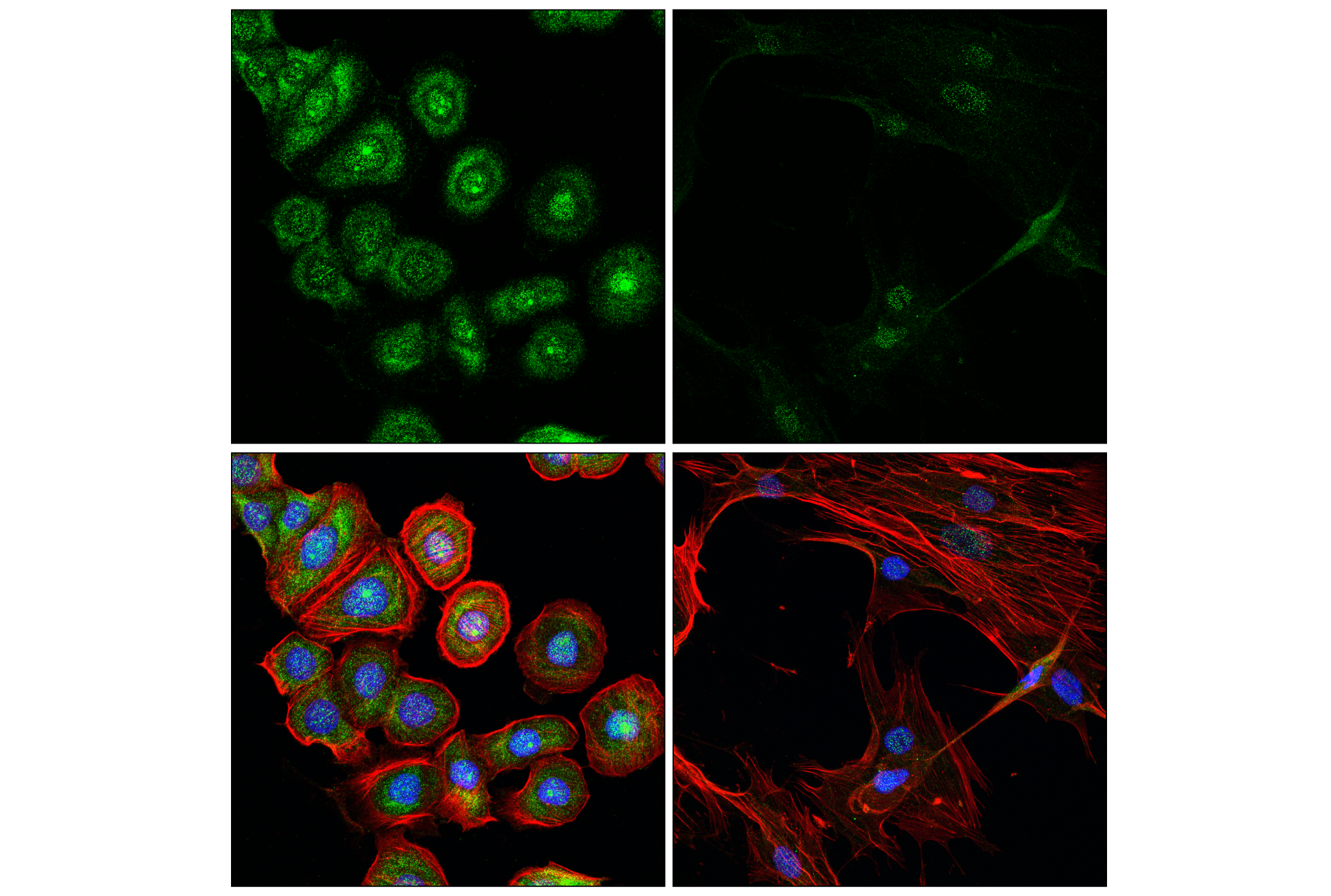 Immunofluorescence Image 1: UPF3B (E5U4C) Rabbit mAb
