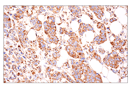 Immunohistochemistry Image 2: Glutaminase-1/GLS1 (E9H6H) XP® Rabbit mAb