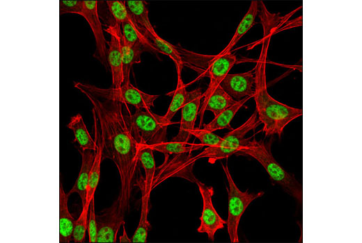 Immunofluorescence Image 1: IWS1 Antibody
