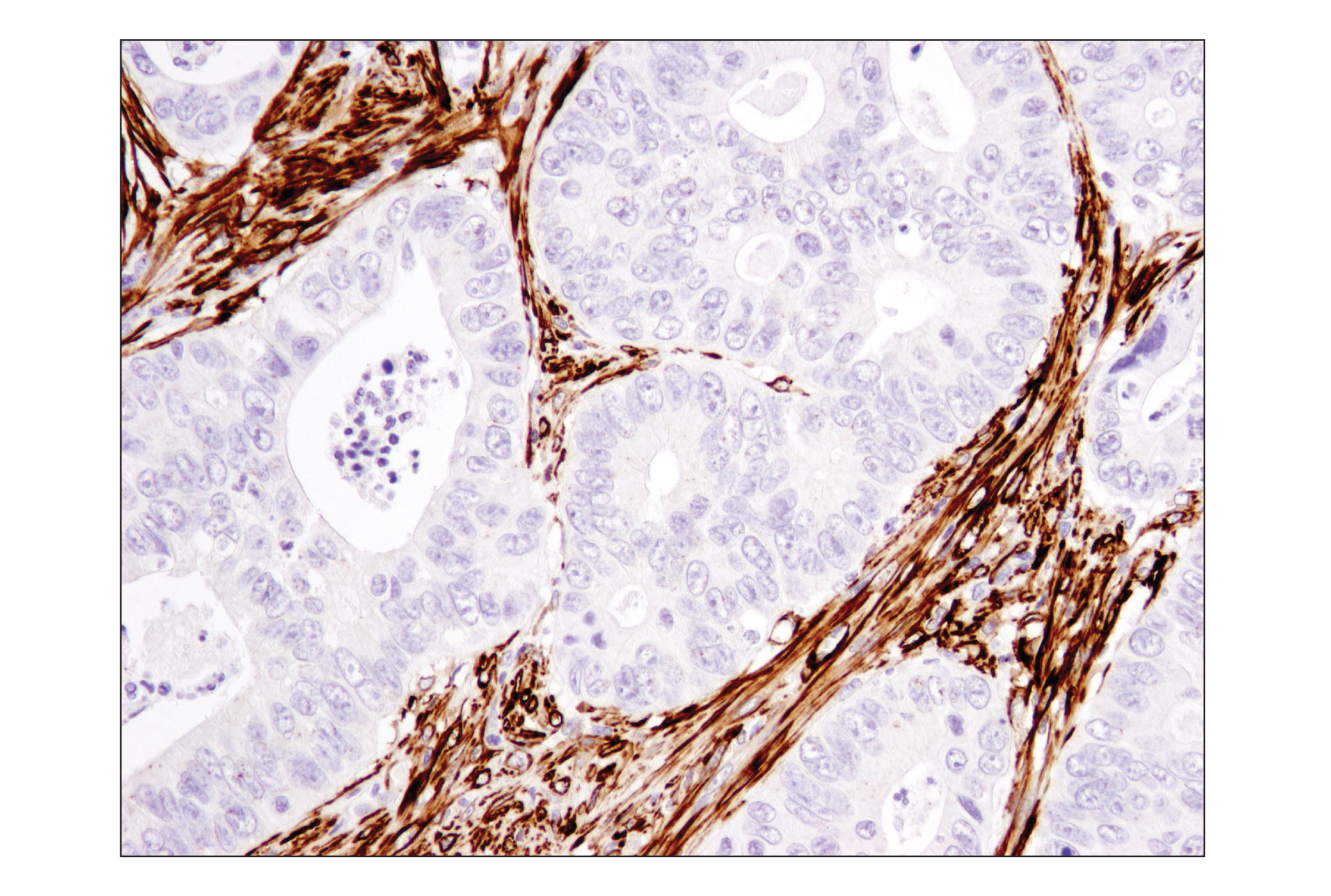 Immunohistochemistry Image 2: α-Smooth Muscle Actin (1A4) Mouse mAb (IHC Formulated)