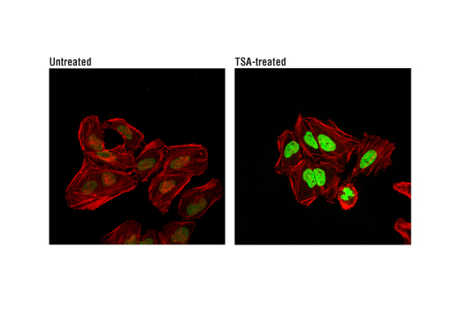 Immunofluorescence Image 1: Acetyl-Histone H4 (Lys16) (E2B8W) Rabbit mAb (Alexa Fluor® 488 Conjugate)