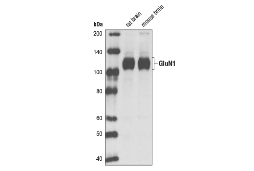 Western Blotting Image 1: NMDA Receptor 1 (GluN1) (D65B7) Rabbit mAb