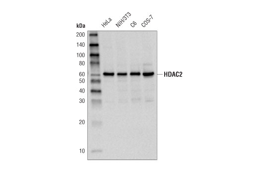  Image 3: Class I HDAC Antibody Sampler Kit