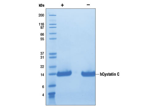  Image 1: Human Cystatin C (hCystatin C)