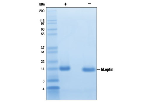  Image 4: Human Leptin/OB (hLeptin)