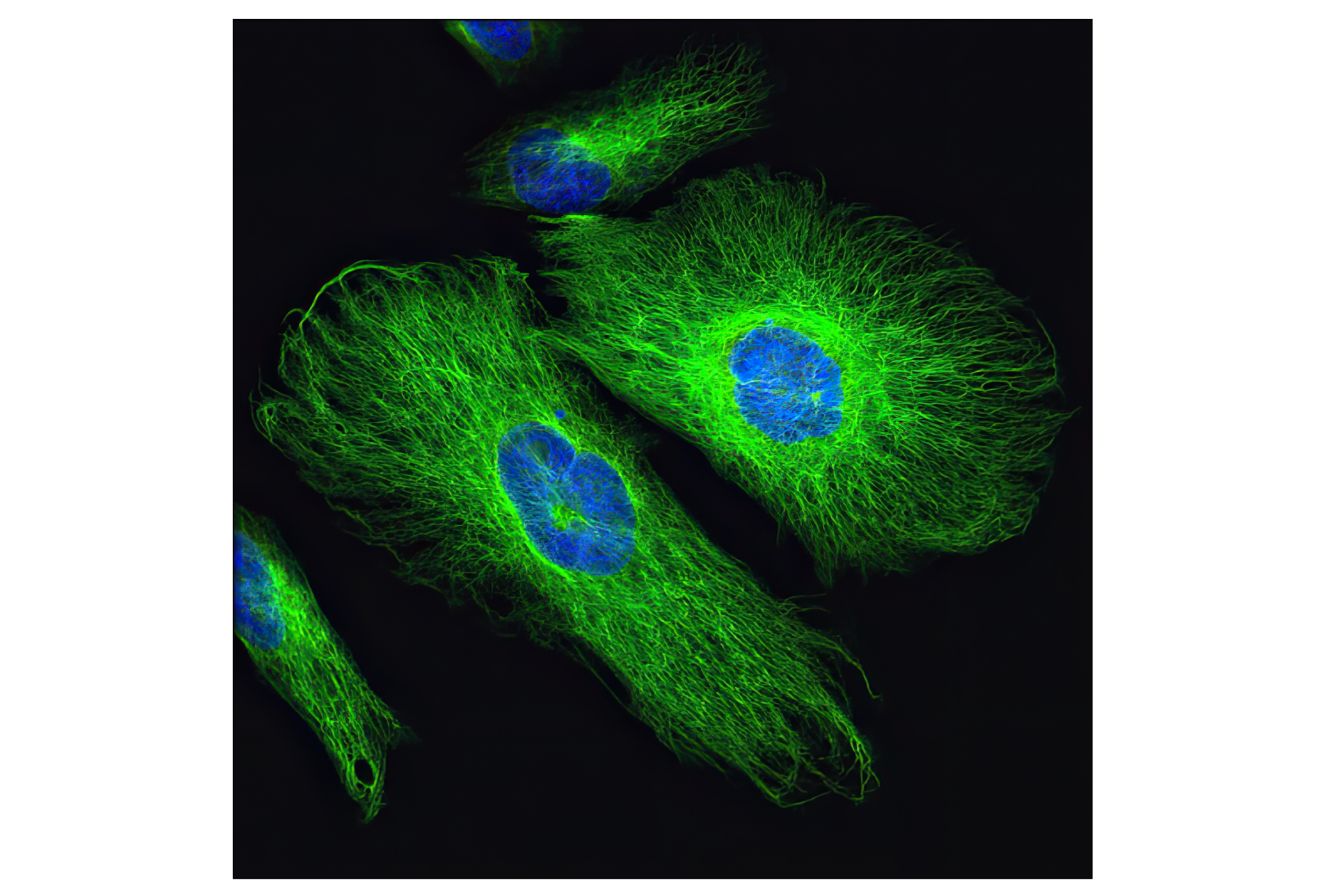 Immunofluorescence Image 4: Vimentin (D21H3) XP® Rabbit mAb