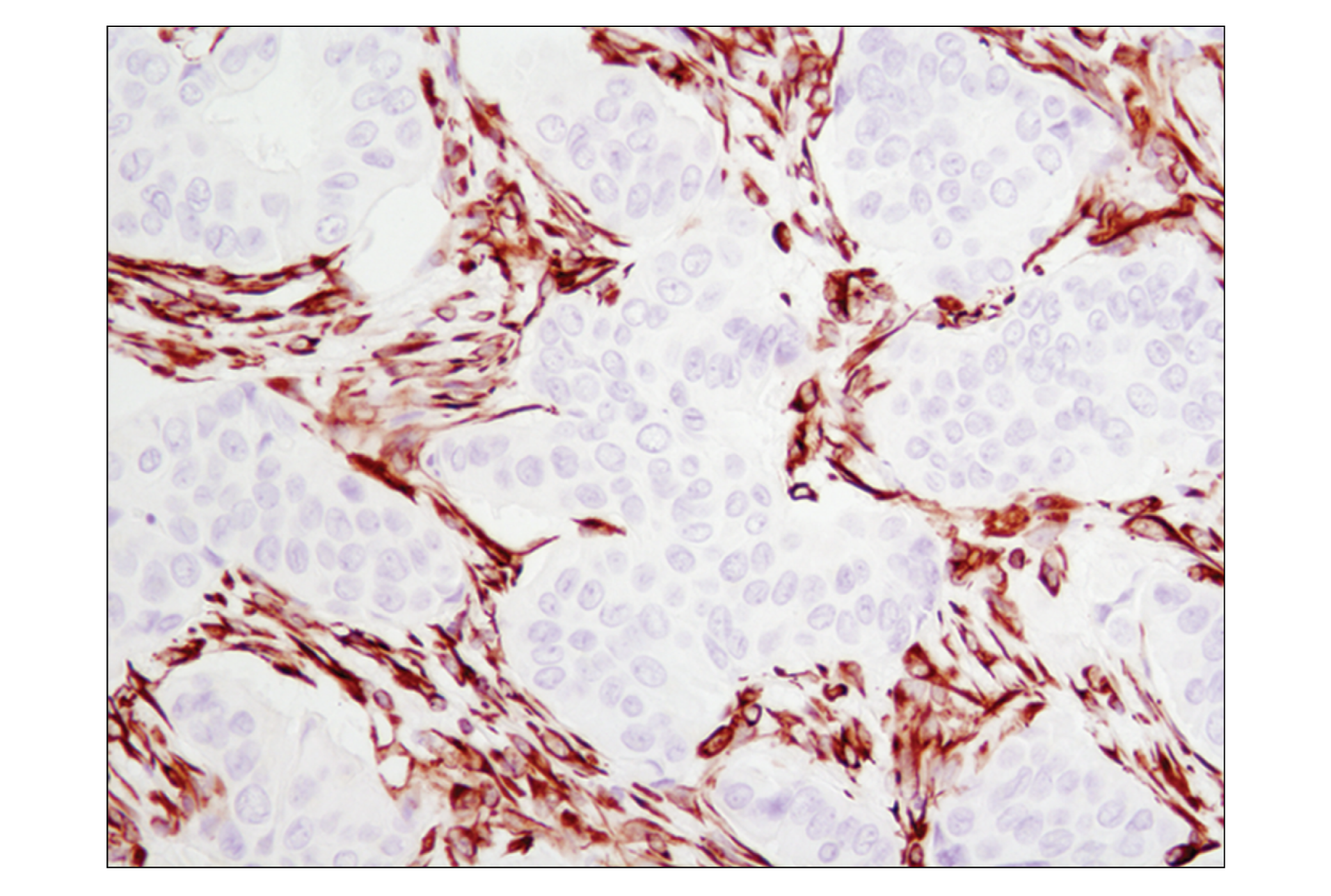 Immunohistochemistry Image 3: Vimentin (D21H3) XP® Rabbit mAb