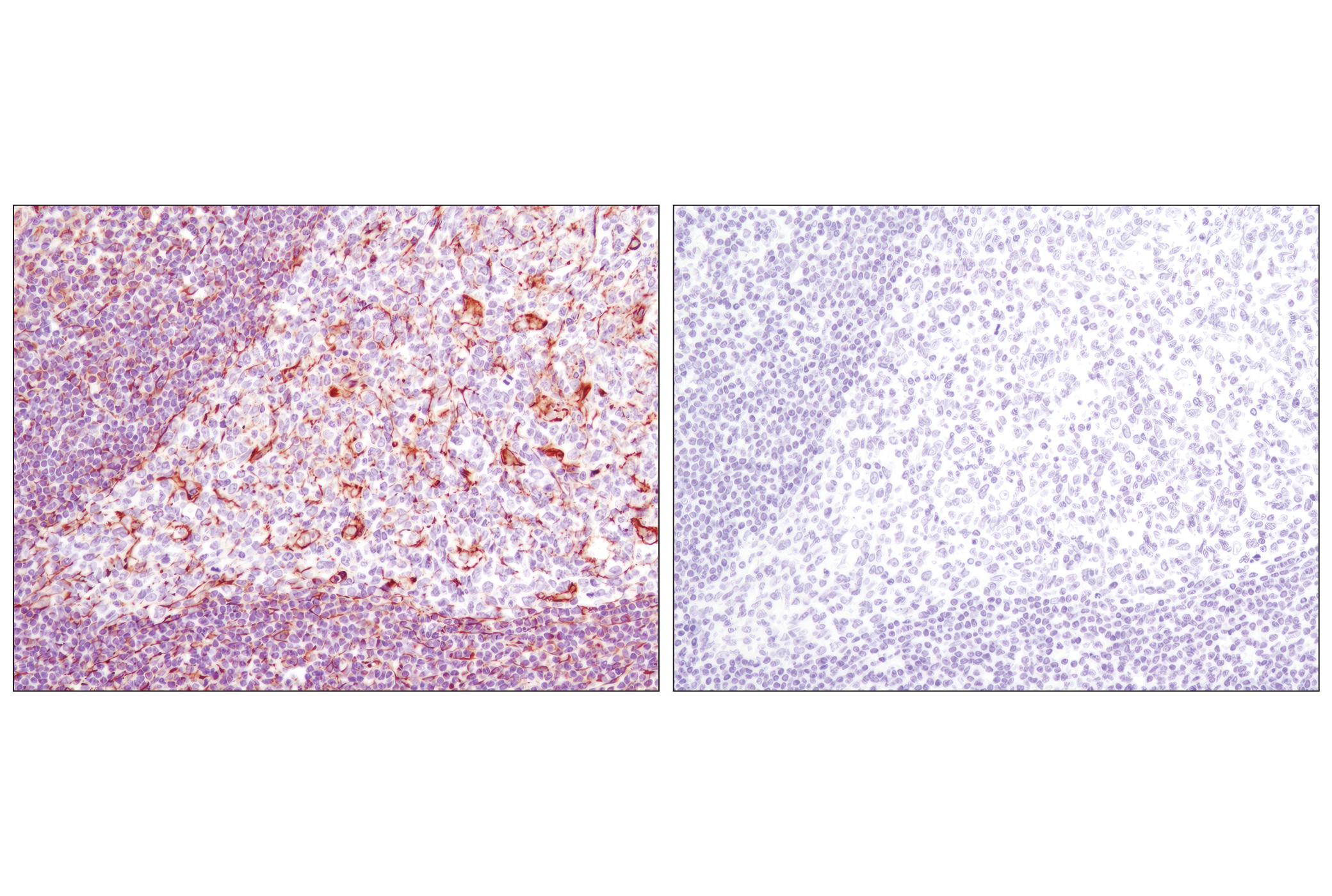  Image 48: Cytoskeletal Marker Antibody Sampler Kit