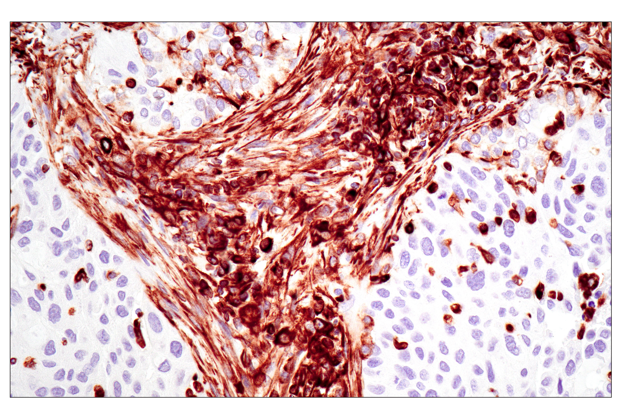  Image 30: Epithelial-Mesenchymal Transition (EMT) IF Antibody Sampler Kit